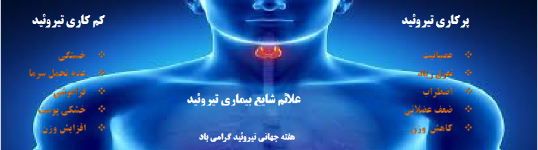 تیرویید